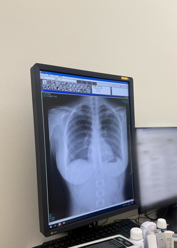 【画像】まんさん、健康診断のレントゲン検査で肺が綺麗なことアピールした結果