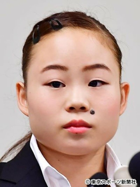 【悲報】新体操のほくろの人、ほくろを除去してた （※画像あり）