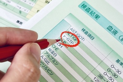 【悲報】γ-GTP400超えアルコール依存ワイ、酒飲んで病院行くも医者にブチギレられる