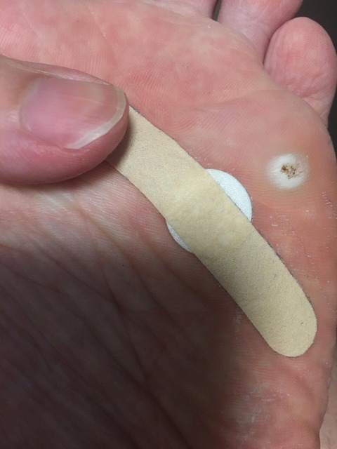 【ﾀｽｹﾃ】足にヤバいものできた…