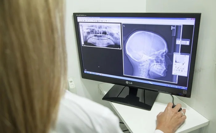 【画像】爆乳美女のレントゲン写真がエロすぎるwww