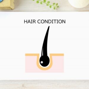 AGA治療してるけど質問ある？