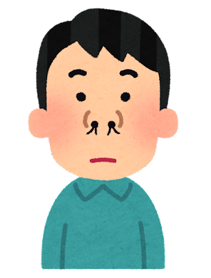 【悲報】鼻毛カッター買って鼻毛剃りまくったら『こう』なったwww