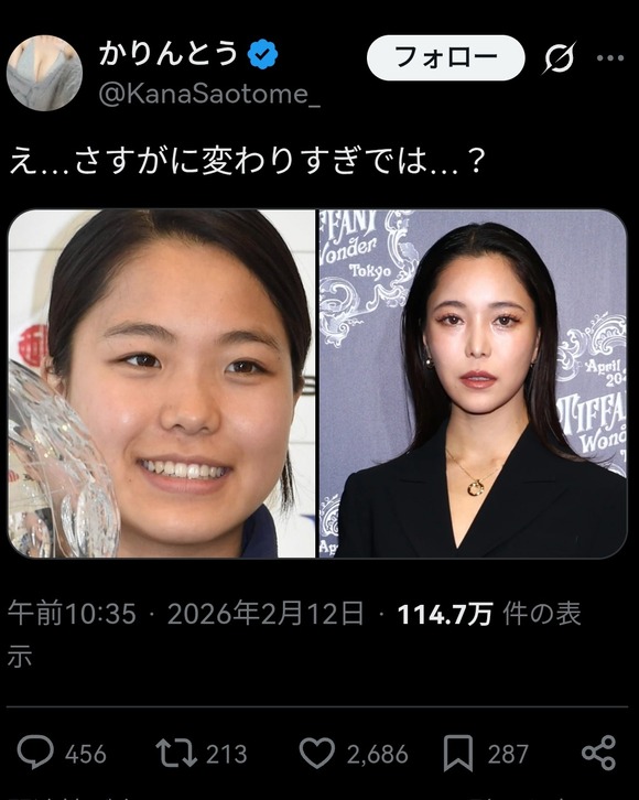 【画像】高梨沙羅さん、顔が変わったと指摘されてしまうwww
