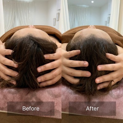 【画像】JK「脳洗浄ほんっとにね最高すぎる！顔が短くなって、足がスッキリするの～ｗ」