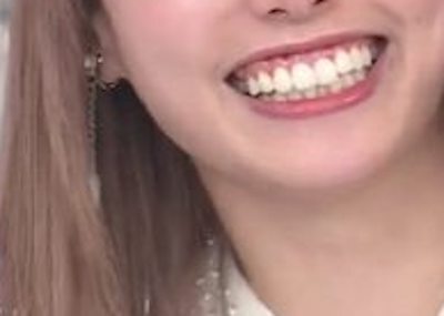 【画像】ぼる塾のアイドルみたいな子、ガチでめちゃくちゃ可愛くなる！