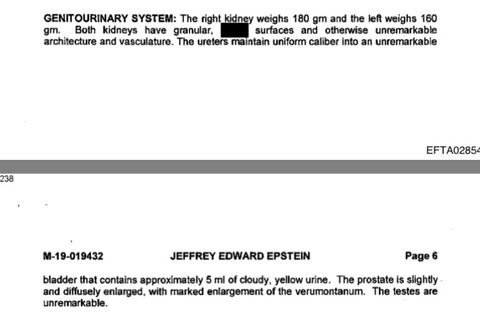 【画像】エプスタインの死体とされていた物、別人だった可能性が出てきてしまう