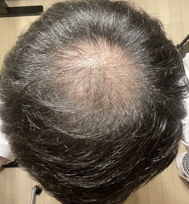 【画像】令和男子、ガチでこの髪型しかおらず横転www