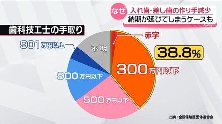 【緊急】お前ら虫歯の治療へ急げ！虫歯の治療できなくなるぞ