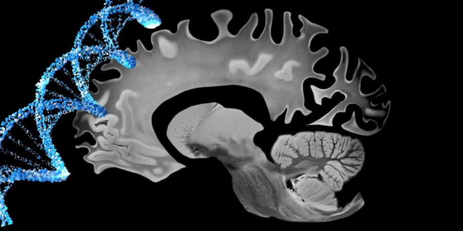 肉を多く食べていると遺伝的にアルツハイマー病になりやすい人も認知症リスクが低くなっていた