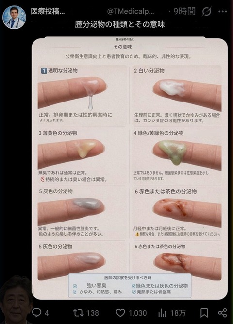 【画像】まんさんから出る液体、多種多様www