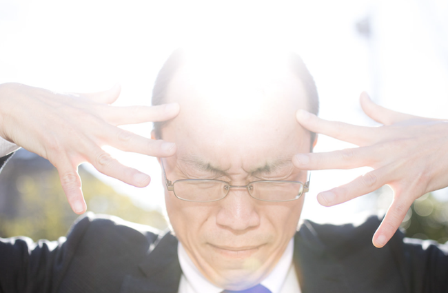 【画像】ハゲ、たった6ヶ月でフサフサにwww