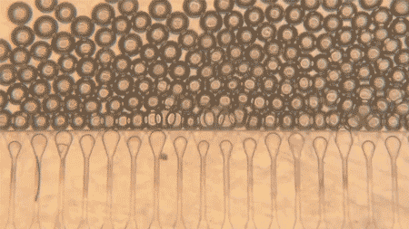 「ミニ肝臓」を注入する新技術、移植を待つ人の希望へ
