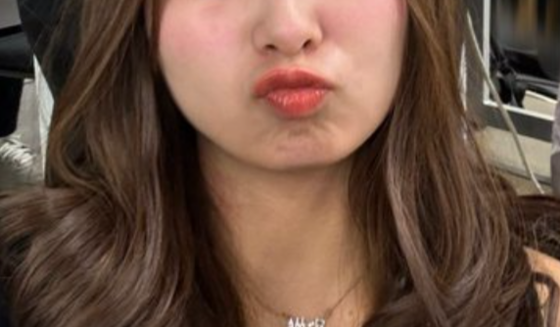 【画像】口ぷっくりポーズとかいう表情をする女ｗｗｗ【Pickup】