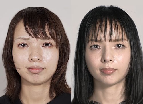 【悲報】顔面整形に5000万円つぎ込んだ美容外科医さんの「無加工ショット」がヤバすぎるwww