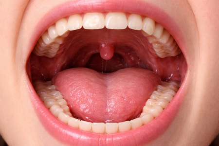 親知らずを抜いた民きなさいよ