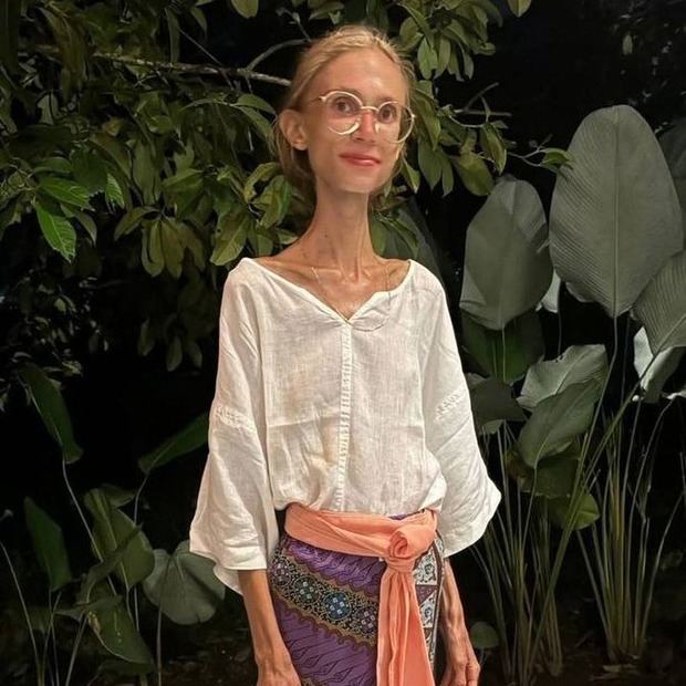 果物だけを食べていた女性、餓死してしまう…