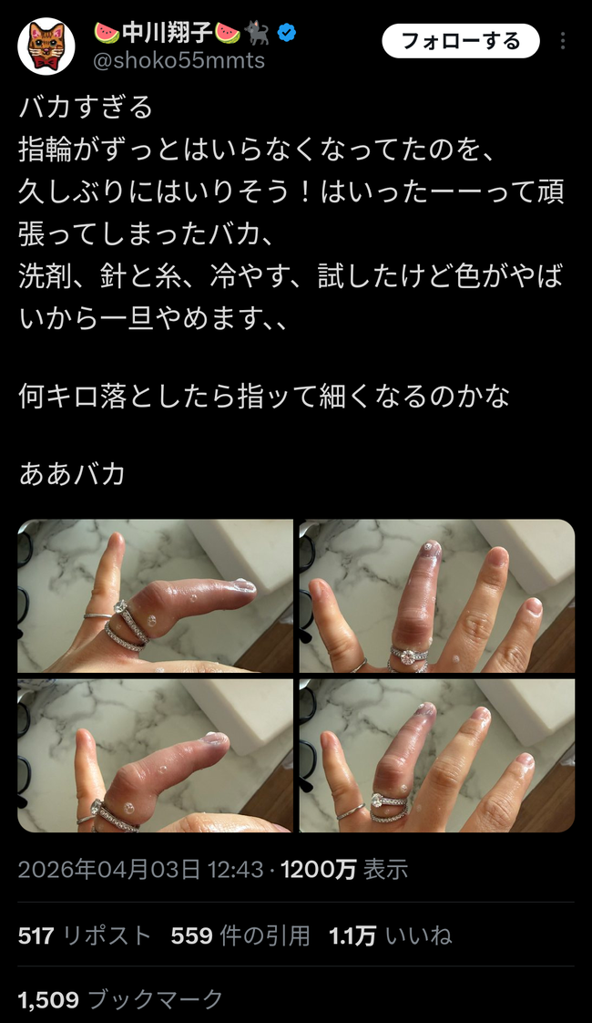 【悲報】中川翔子さん、とんでもないことになってしまう・・・・・