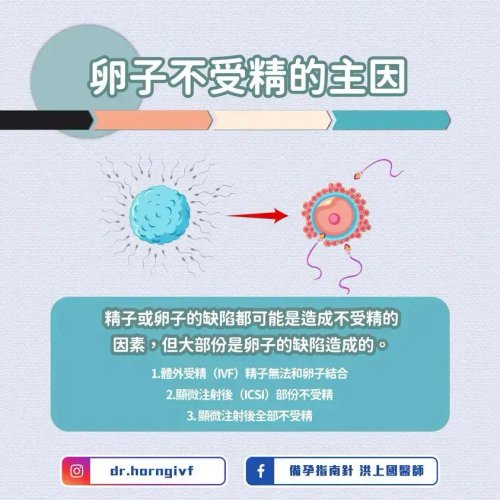 【悲報】卵子さん、精子の4000倍も劣化が早かった 専門家「35歳でほぼ全滅」