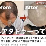 【画像】薄毛男性、タトゥーを入れて完全復活