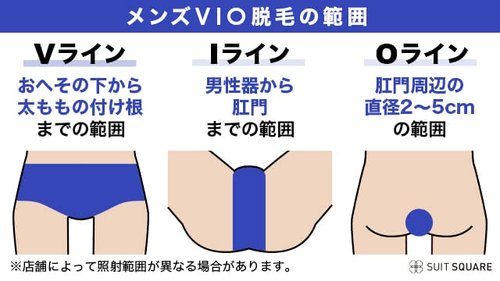 【悲報】VIO脱毛エッッッすぎワロタ
