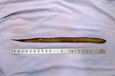 【画像】ベトナムの男性、うなぎに直腸を突き破られて死の淵に