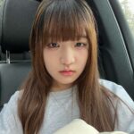 【画像】地雷系女子さん、脂肪吸引で顔面が”金属バット友保”みたいになる