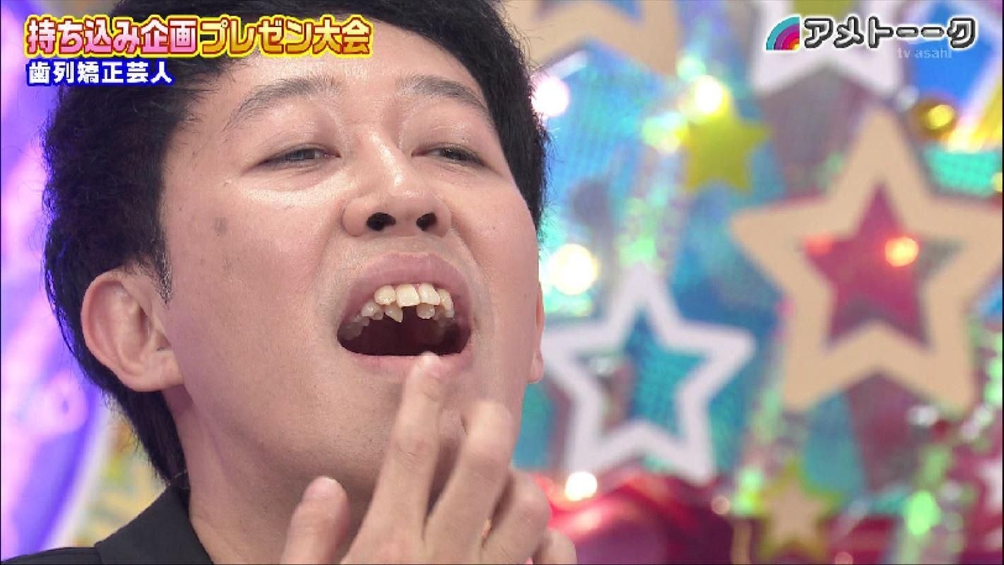 「お笑い芸人の口の中」がスゴイんだが。なんで大人がこんな事になってるの？？？