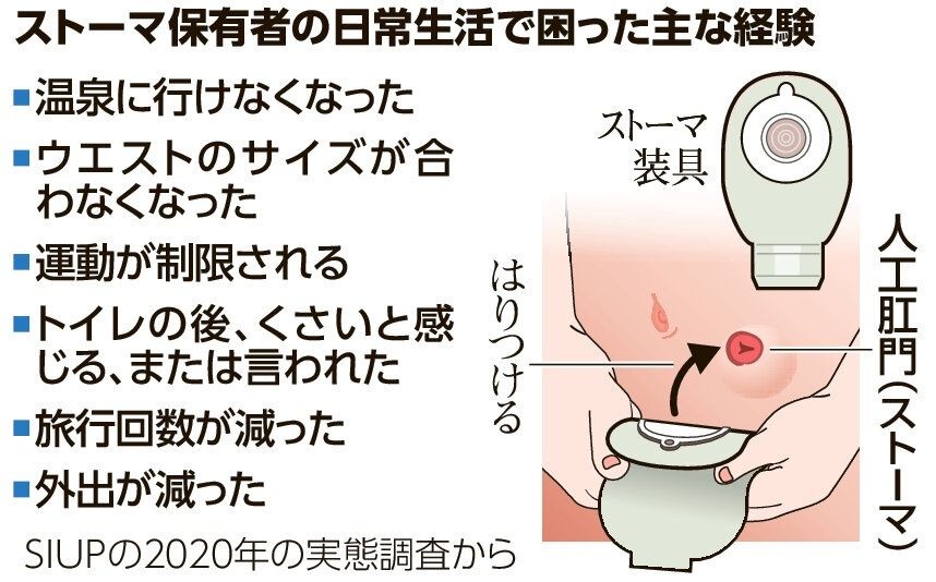 松本人志(62歳)さん、大腸がんで人工肛門を造設 もう旅行に行けない…