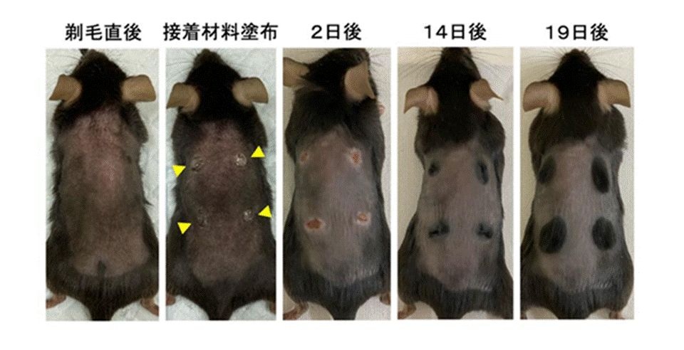 九州歯科大学 「ハゲに接着剤を塗ると毛が生える。ね、簡単でしょ？」