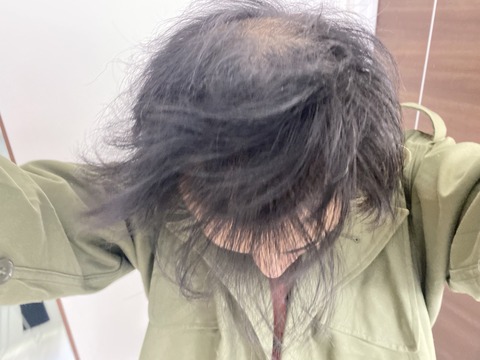 【画像】最近の弱者男性の髪型、全部これwww
