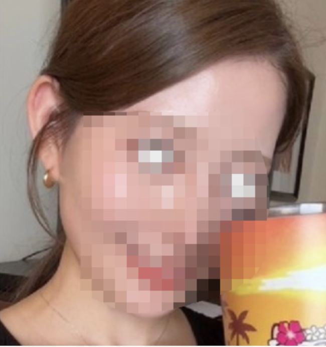 【画像】女さん、たった1箇所の整形で一気に垢抜けるwww